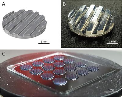 A Reproducible Bioprinted 3D Tumor Model Serves as a Preselection Tool for CAR T Cell Therapy Optimization